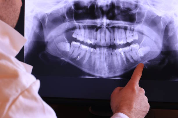 Best Emergency Dental Care for Abscessed Tooth in Agler Beach, FL