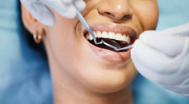 Best Emergency Dentist for Knocked-Out Tooth in Agler Beach, FL